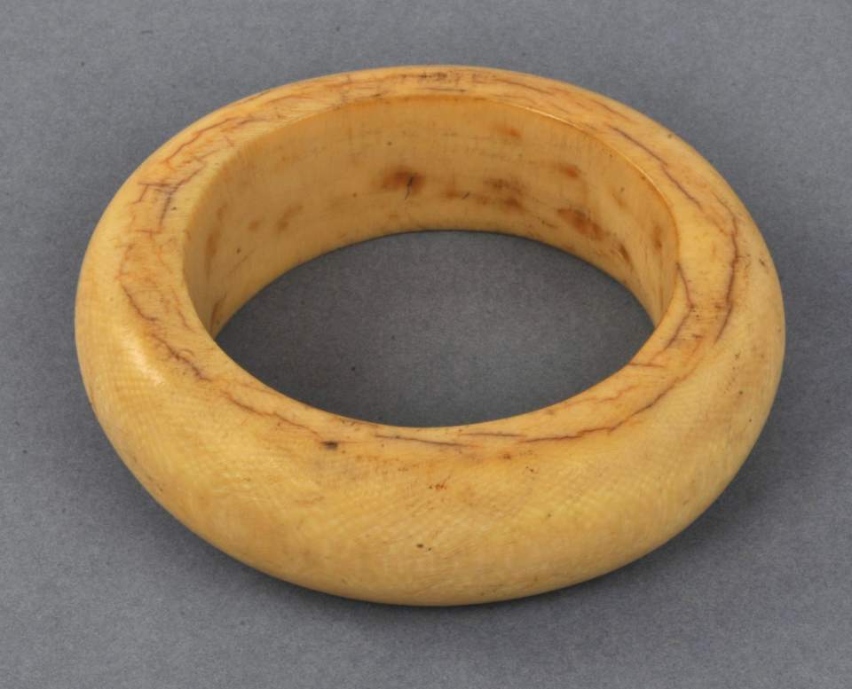 Arm- oder Beinring 