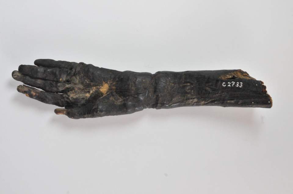 Mumifizierte Hand